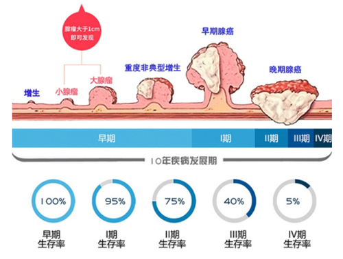 直肠癌早筛试剂盒“第一证”—足不出户而明察秋毫